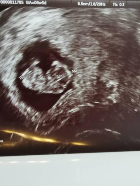 Bild zu 1. MuVo 8+5 - Forum für Februar - Mamis