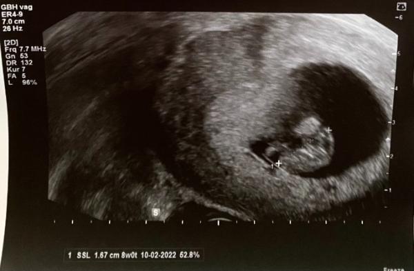 Bild zu Neues Foto 😍 - Forum für Februar - Mamis