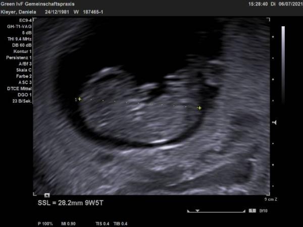 Bild zu Darf ich zu euch - Forum für Februar - Mamis