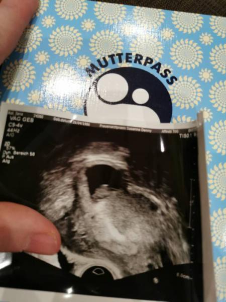 Bild zu Zurück von FA - Forum für Februar - Mamis