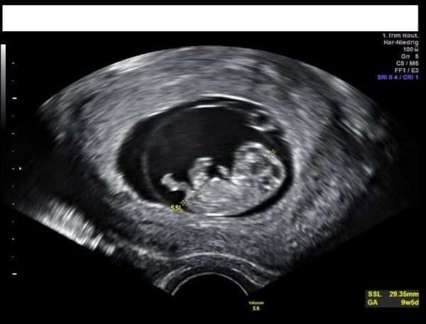 Bild zu Zurück vom FA - Forum für Februar - Mamis