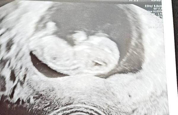 Bild zu Update - Forum für Februar - Mamis