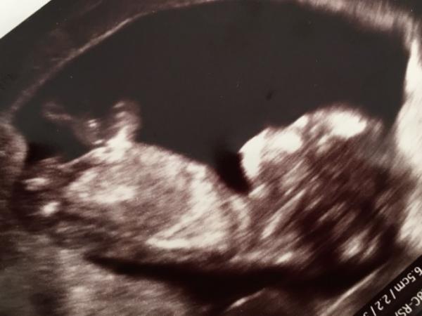 Bild zu Mädchen oder Junge - Forum für Februar - Mamis