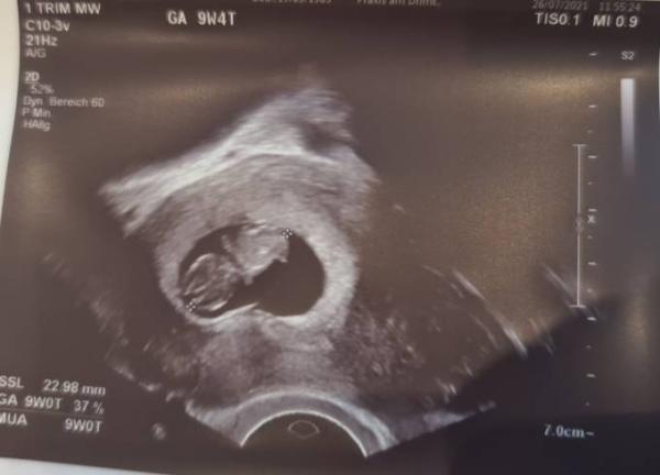 Bild zu Wir rutschen in die 10 SSW - Forum für Februar - Mamis