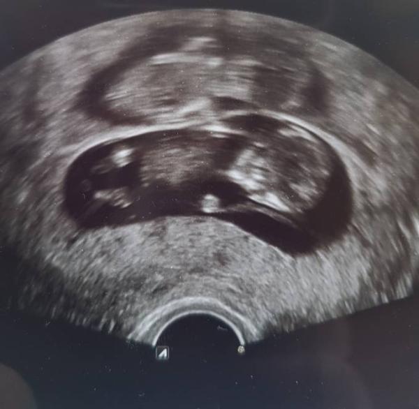 Bild zu Ich könnte die ganze Welt umarmen - Forum für Februar - Mamis