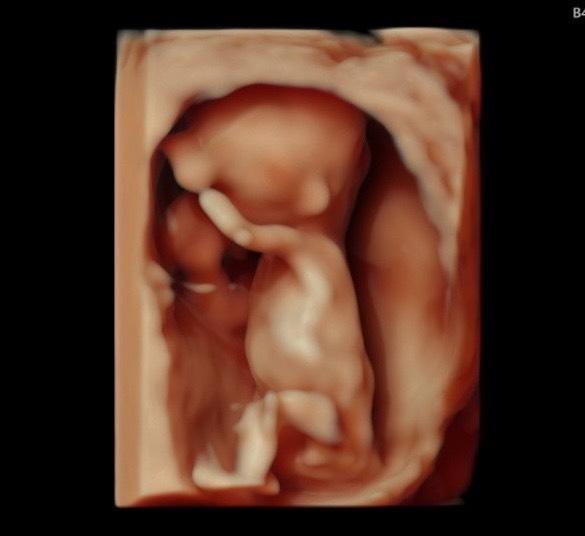 Bild zu Preanatalschall - Forum für Februar - Mamis