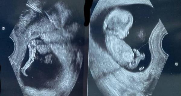 Bild zu Baby macht Party im Bauch - Forum für Februar - Mamis