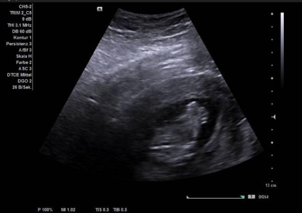 Bild zu Fa Termin - Forum für Februar - Mamis