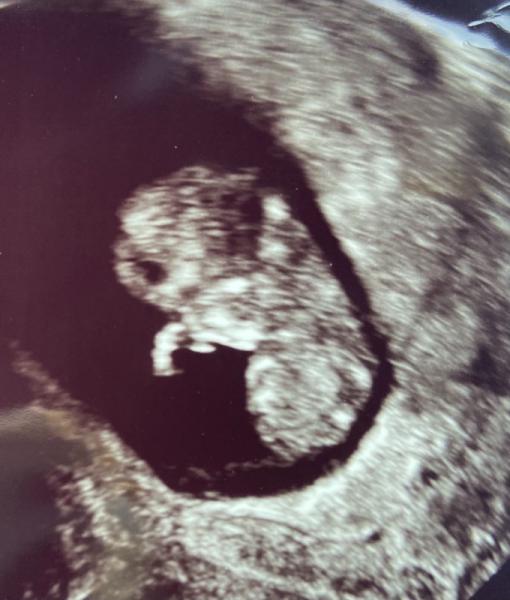 Bild zu Termin heute - Forum für Februar - Mamis