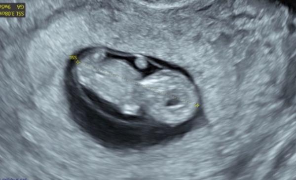 Bild zu Junge oder Mädchen/ Nub theorie - Forum für Februar - Mamis