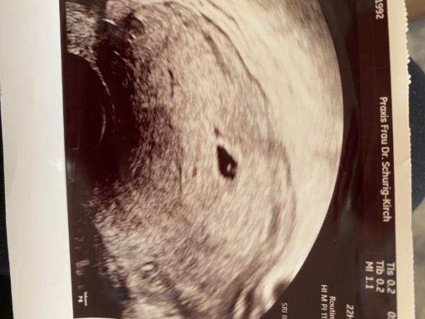 Bild zu Freude Teilen. Baby nr. 2! ♥️ - Forum für Februar - Mamis