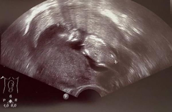 Bild zu Termin heute - Forum für Februar - Mamis