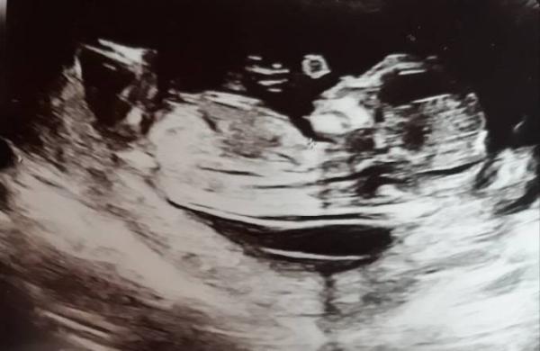 Bild zu Zurück vom ETS - Forum für Februar - Mamis