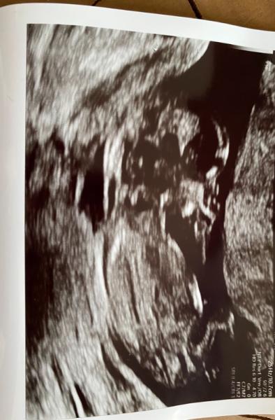 Bild zu Geschlecht - Forum für Februar - Mamis
