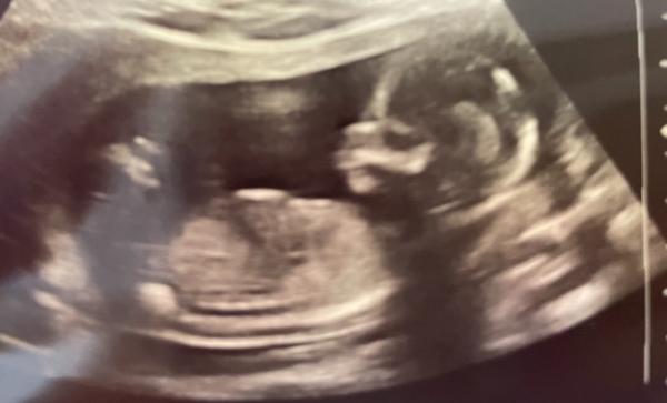 Bild zu Mädchen oder Junge? - Forum für Februar - Mamis