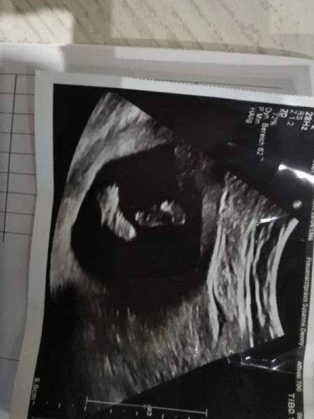 Bild zu Druckgefühl - Forum für Februar - Mamis