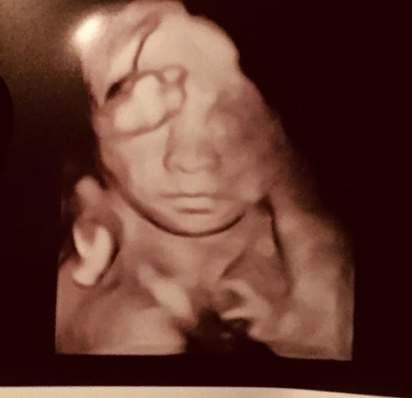 Bild zu Stolz wie Oskar 💚 - Forum für Februar - Mamis