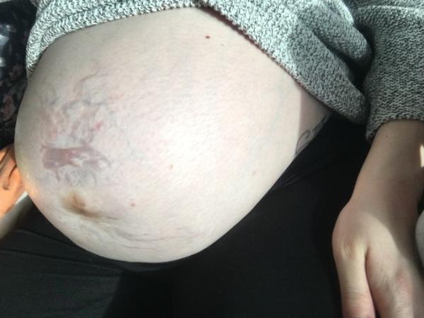 Bild zu Dickbauchdienstag 🥳 - Forum für Februar - Mamis