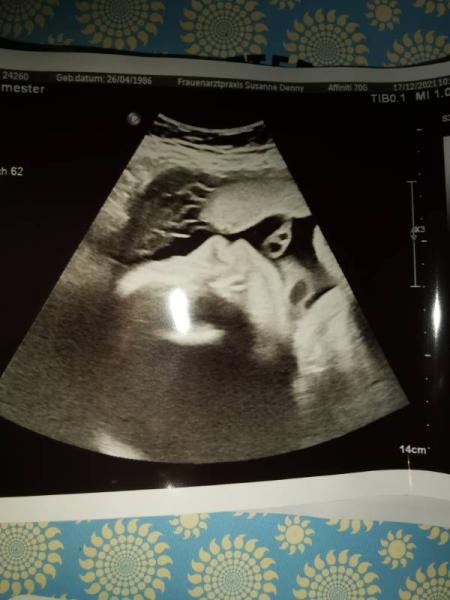 Bild zu Fa Termin - Forum für Februar - Mamis