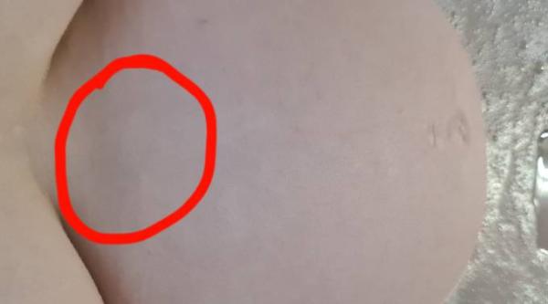 Bild zu Taubes Gefühl/ Brennen - Forum für Februar - Mamis