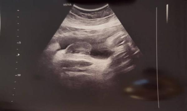 Bild zu Geschlecht ? - Forum für Februar - Mamis