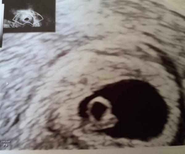 Bild zu Erster Gyn Termin - Forum für Februar - Mamis
