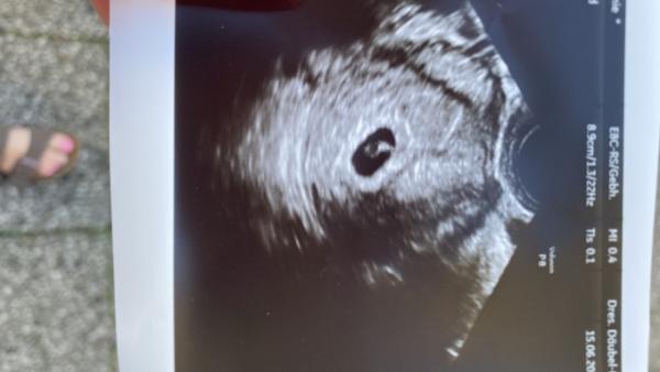 Bild zu Steige bei euch ein - Forum für Februar - Mamis