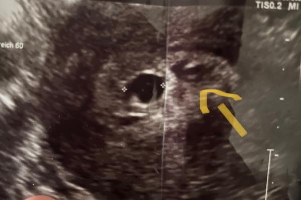 Bild zu Ich bitte um eure Hilfe.. was ist das? - Forum für Februar - Mamis