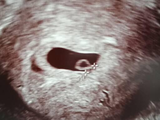 Bild zu Hi Mamis neue hier.. - Forum für Februar - Mamis