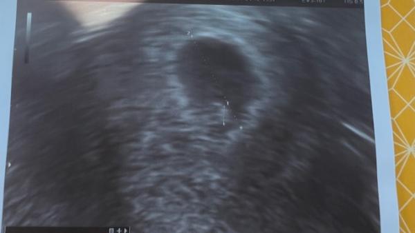 Bild zu Erster Termin 7.SSW - Forum für Februar - Mamis