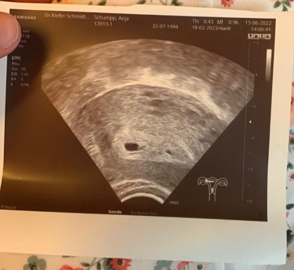 Bild zu Könnten das Zwillinge sein? - Forum für Februar - Mamis