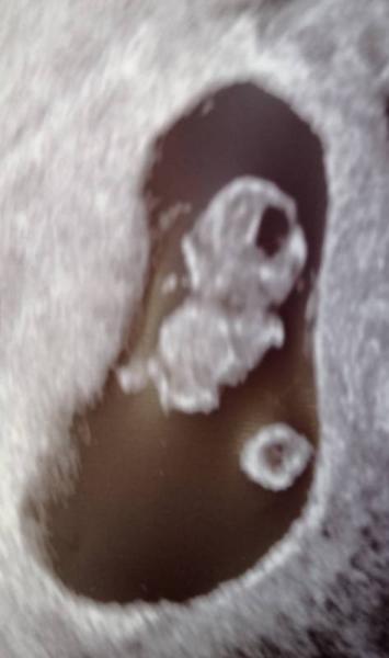 Bild zu Termin heute - Forum für Februar - Mamis