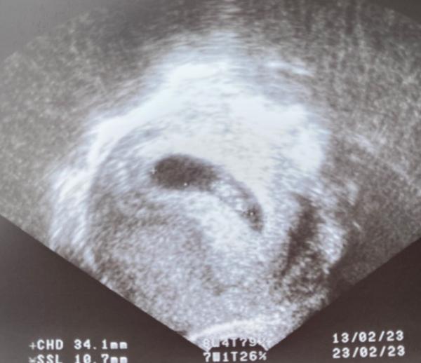 Bild zu Muss an 7+2 eine Herzaktion feststellbar sein, wenn SSL 10,7mm? - Forum für Februar - Mamis