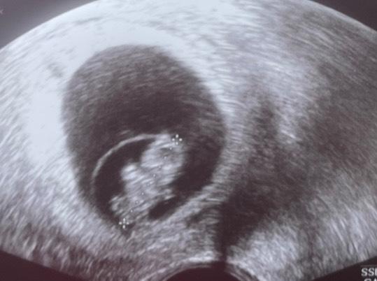 Bild zu Gummibärchen - Forum für Februar - Mamis