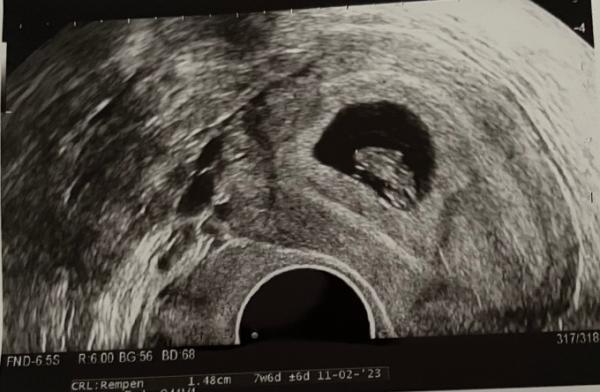 Bild zu Aufmunterung benötigt - Forum für Februar - Mamis