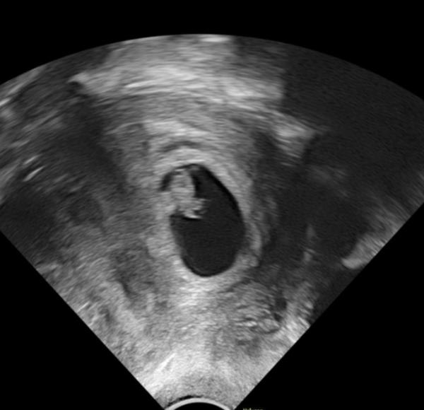 Bild zu Ultraschall an 7+4 ❤️ - Forum für Februar - Mamis