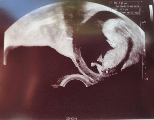 Bild zu Alles gut! 2. Ultraschall - Forum für Februar - Mamis