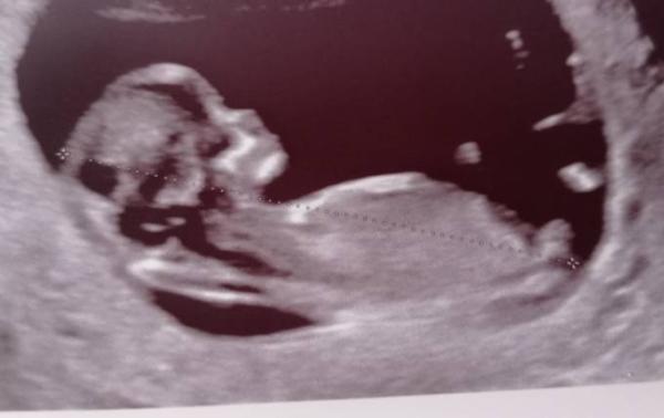 Bild zu Termin heute - Forum für Februar - Mamis