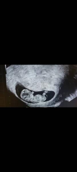 Bild zu Tabletten - Forum für Februar - Mamis