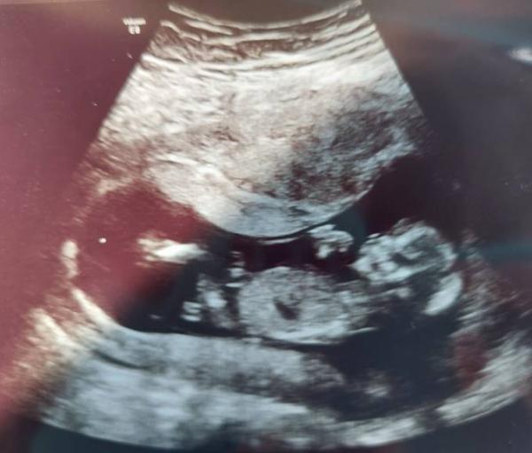 Bild zu NUB Experten - Forum für Februar - Mamis