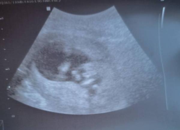 Bild zu Geschlecht - Forum für Februar - Mamis