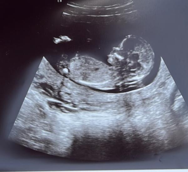 Bild zu Nub Theorie? - Forum für Februar - Mamis
