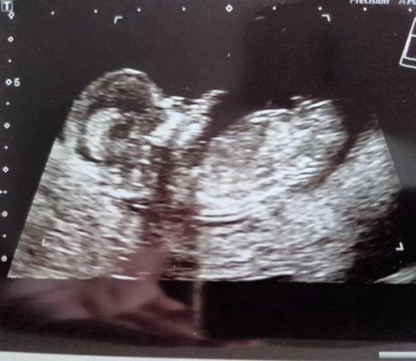 Bild zu Ratet mal bitte mit :-) - Forum für Februar - Mamis