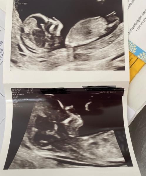 Bild zu Nub - wer hat eine Theorie ? - Forum für Februar - Mamis