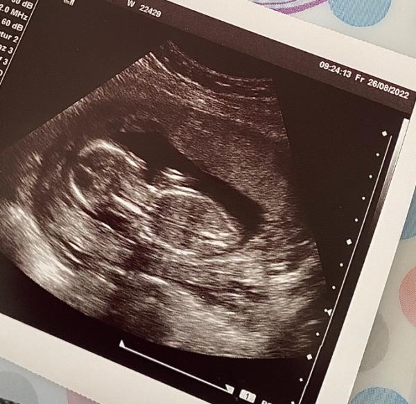 Bild zu Geschlecht erfahren - Forum für Februar - Mamis