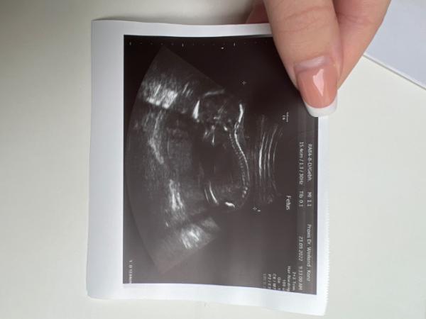 Bild zu SSL - Forum für Februar - Mamis