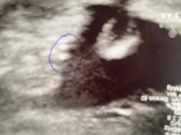 Bild zu Junge oder Mädchen? - Forum für Februar - Mamis