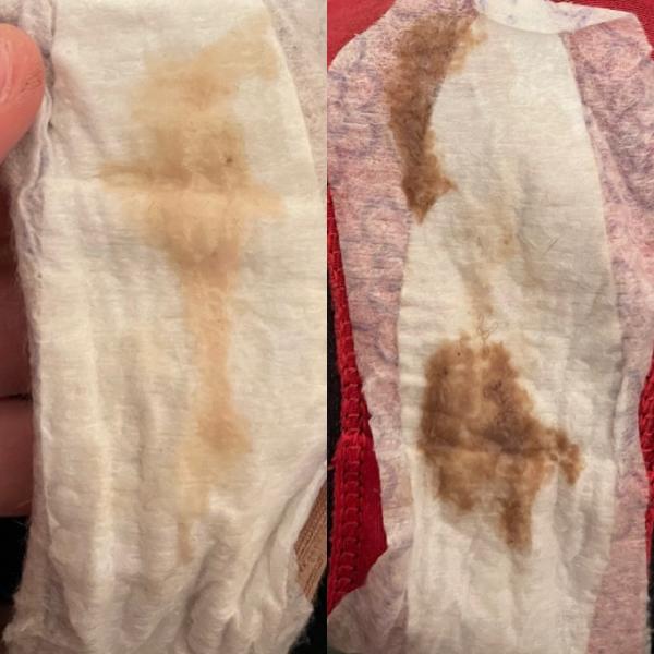 Bild zu Blutung Achtung Bild! (20+3) - Forum für Februar - Mamis