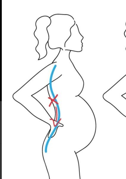 Bild zu Ich glaube/denke Nierenstau 🤔 - Forum für Februar - Mamis