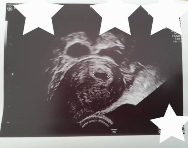 Bild zu Update Frauenarzt - Forum für Februar - Mamis